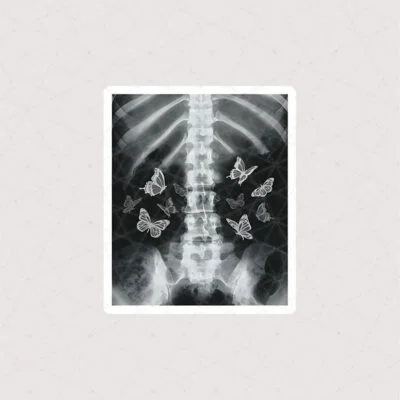 استیکر X-RAY بدن انسان طرح پروانه ای به رنگ سیاه سفید