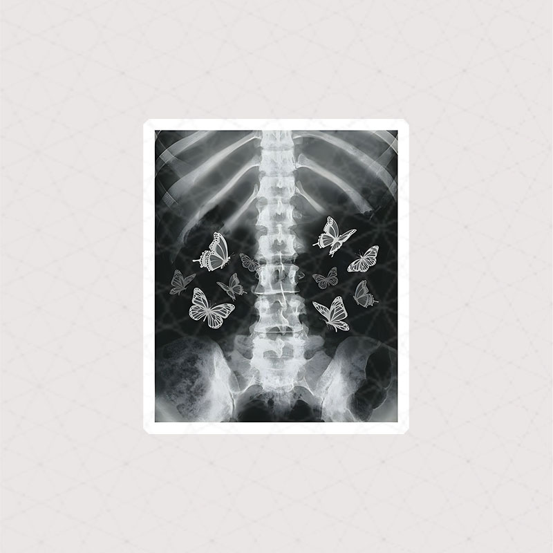 استیکر X-RAY بدن انسان طرح پروانه ای به رنگ سیاه سفید
